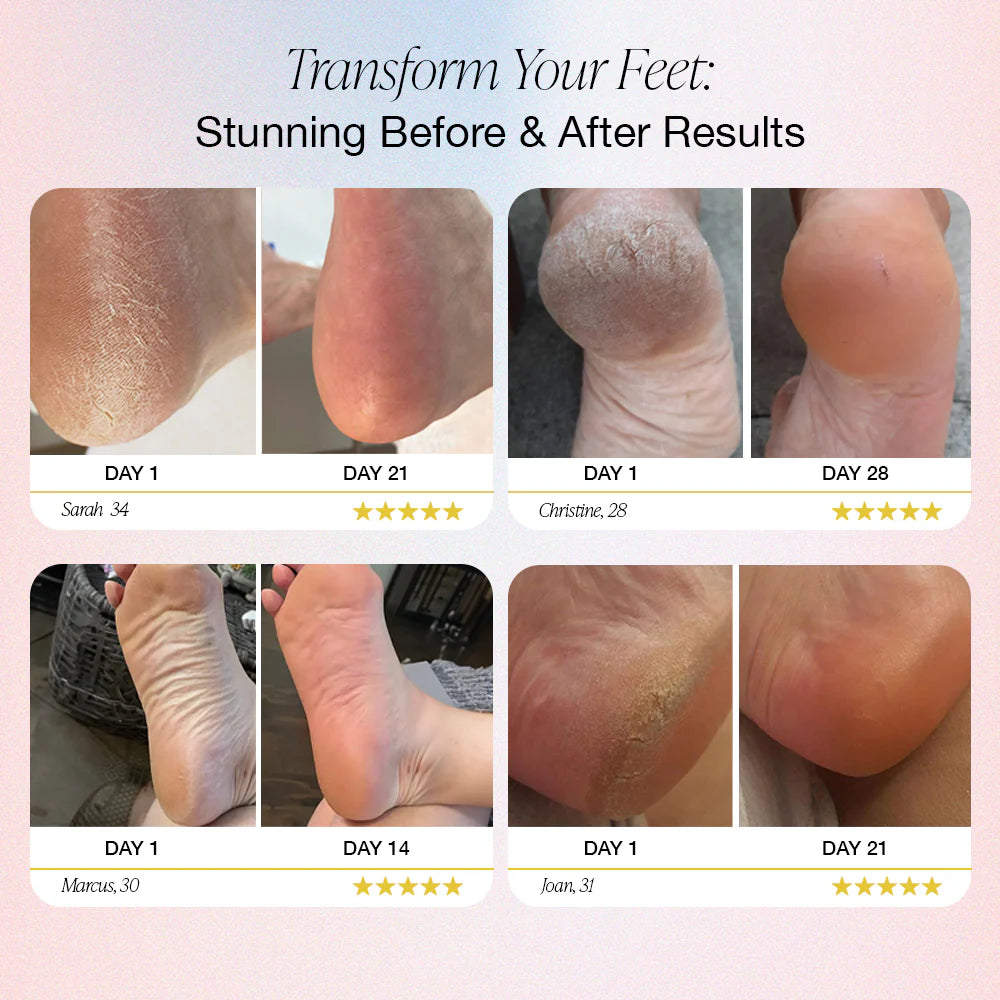 Blovanda Glow™ – Pro Foot Care