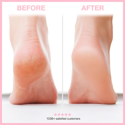 Blovanda Glow™ – Pro Foot Care