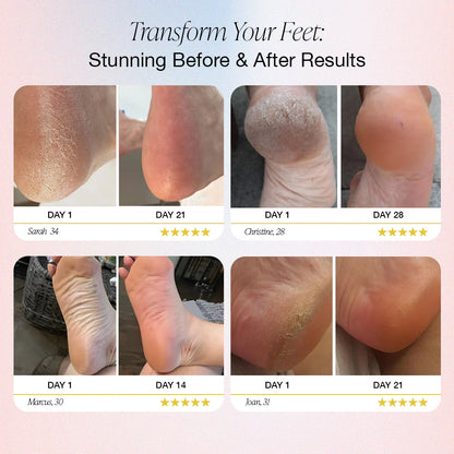 Blovanda Glow™ – Pro Foot Care